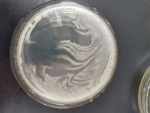 這是菌落蔓延嗎？食品微生物檢測(cè)中的常見(jiàn)問(wèn)題與指導(dǎo)建議